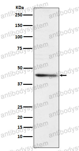 Anti-RRM2 Antibody (R1U20)