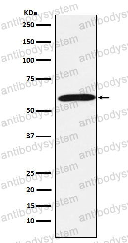 Anti-CASQ1 Antibody (R1U23)