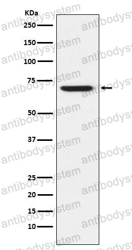 Anti-GABRA5 Antibody (R1U25)