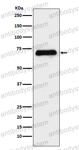Anti-SLC6A4 Antibody (R1U26)