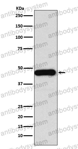 Anti-DNAJA1 Antibody (R1U27)