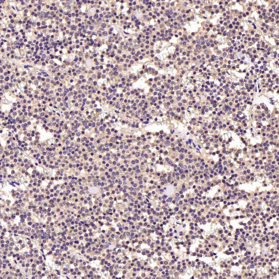 Anti-AKT1/2/3 Antibody (R1C47)