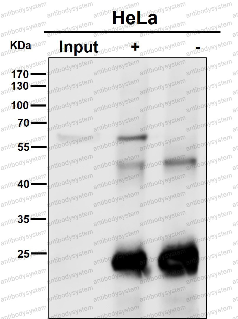 Anti-AKT1/2/3 Antibody (R1B67)