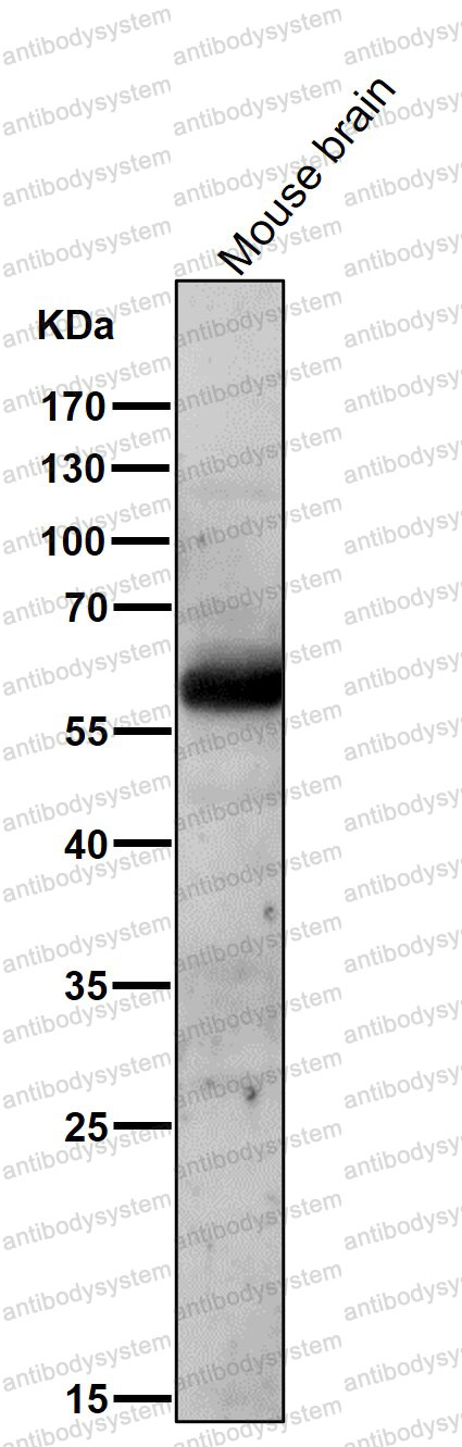 Anti-AKT1/2 Antibody (R1U28)