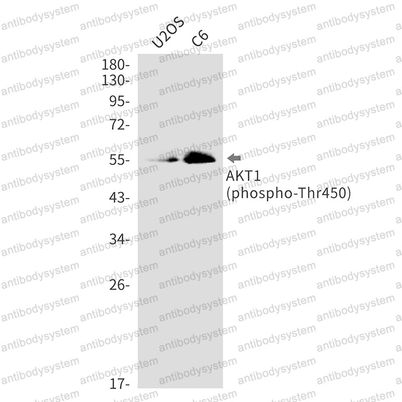Anti-Phospho-AKT1 (Thr450) Antibody (R1U29)