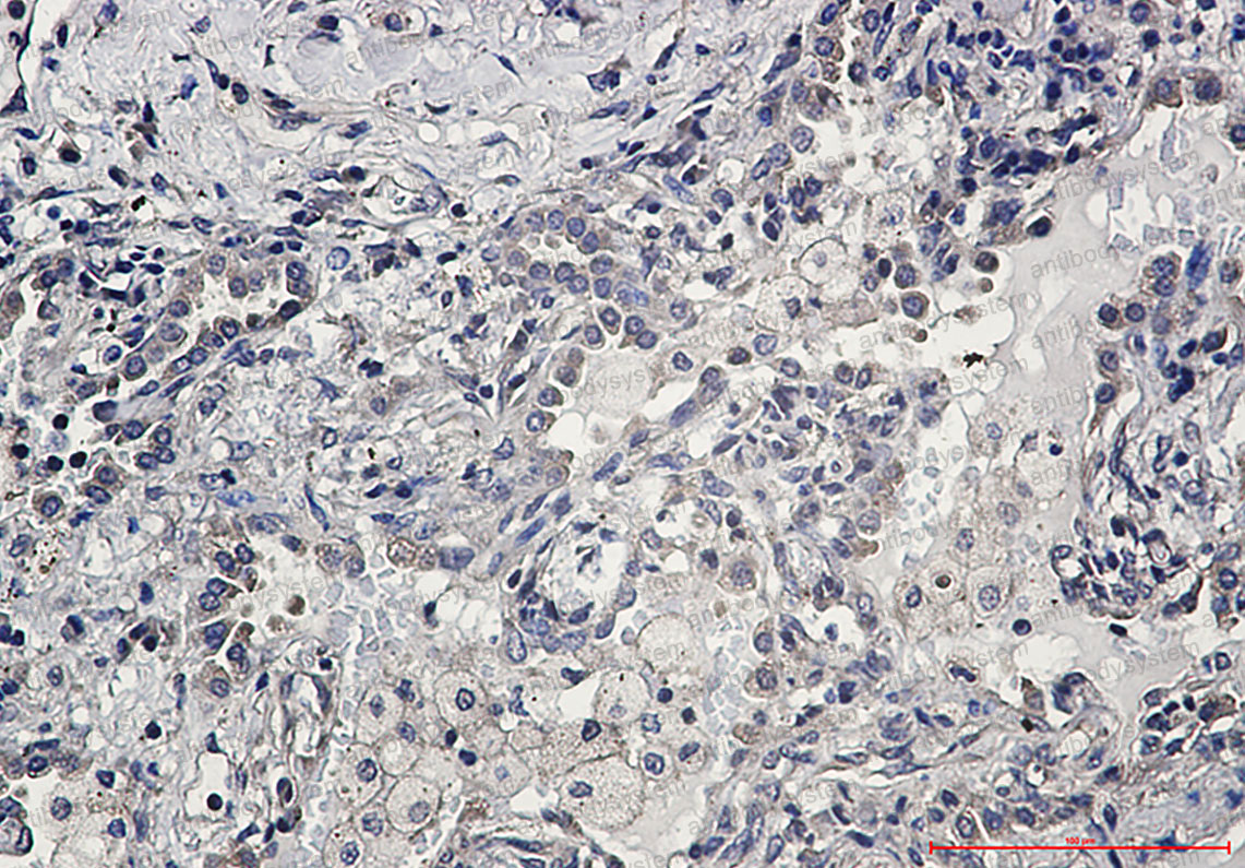 Anti-AKT1 Antibody (R1U31)