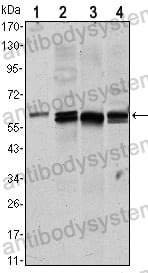 Anti-AKT1 Antibody (R3J15)