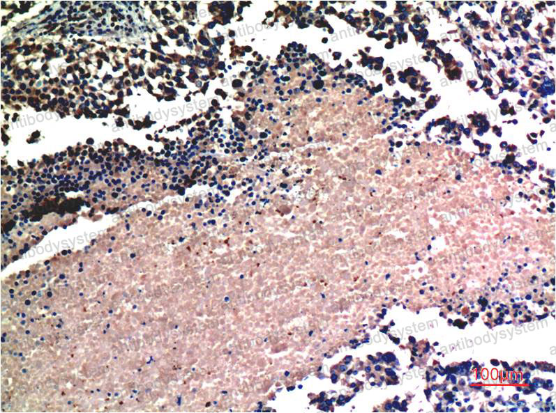 Anti-AKT1 Antibody (R3J18)