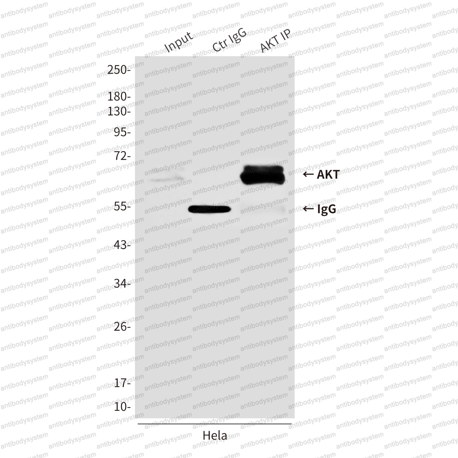 Anti-AKT1/2/3 Antibody (R3J19)