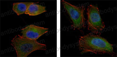 Anti-AKT2 Antibody (R3J20)