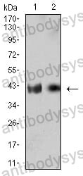 Anti-CD132/IL2RG Antibody (R3J21)