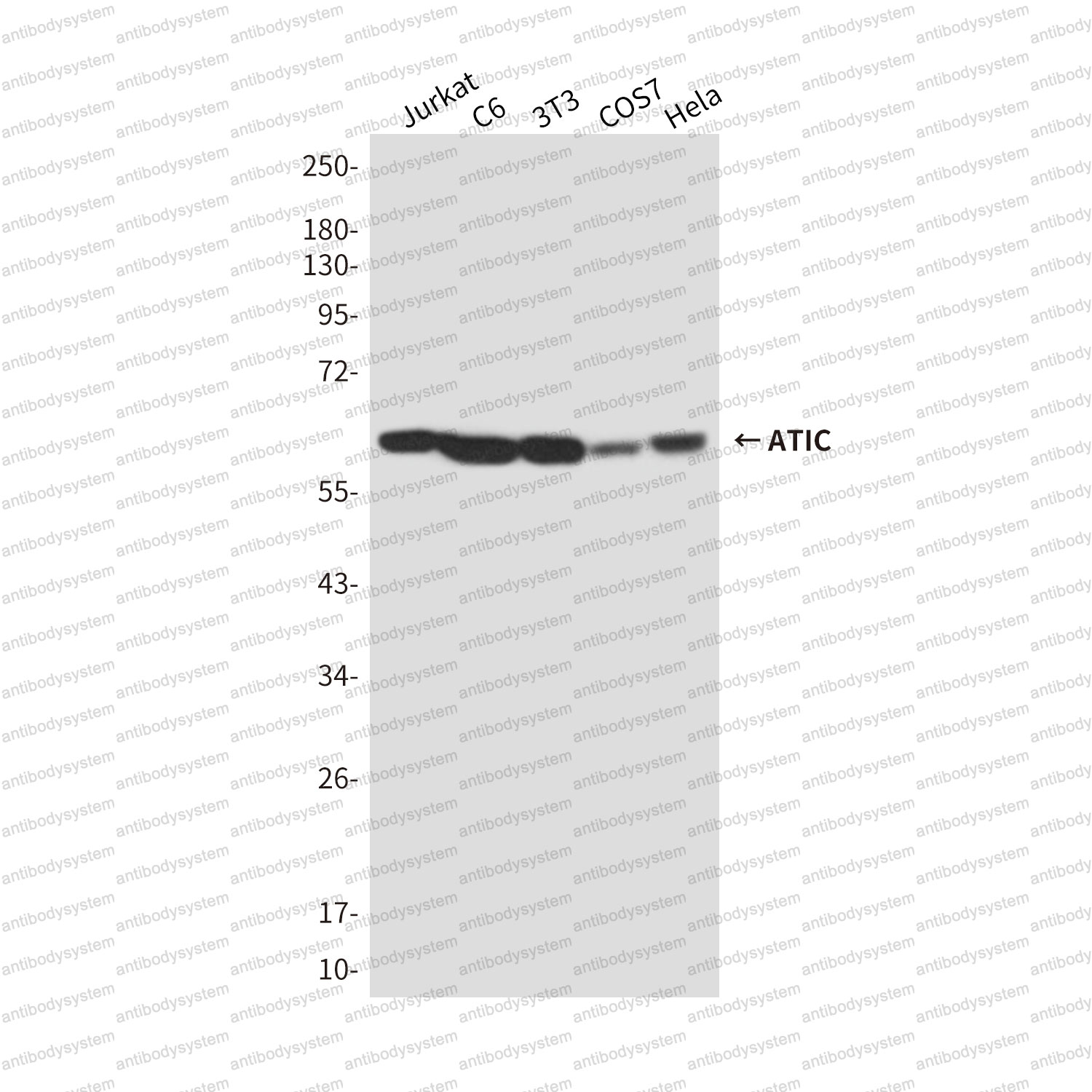 Anti-ATIC Antibody (R3J25)