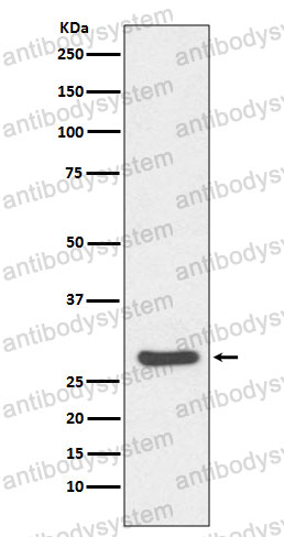 Anti-CASP14 Antibody (R1U32)