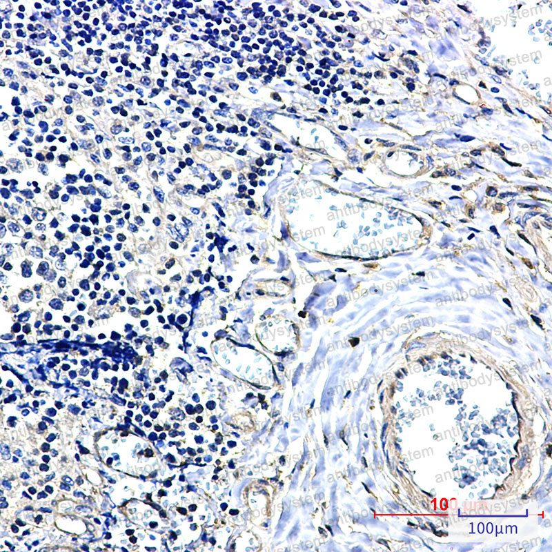 Anti-YWHAB Antibody (R1U36)