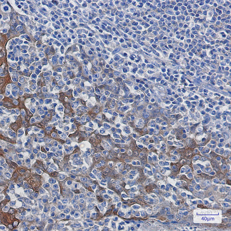 Anti-YWHAB Antibody (R1U35)