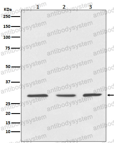 Anti-YWHAB Antibody (R1U34)
