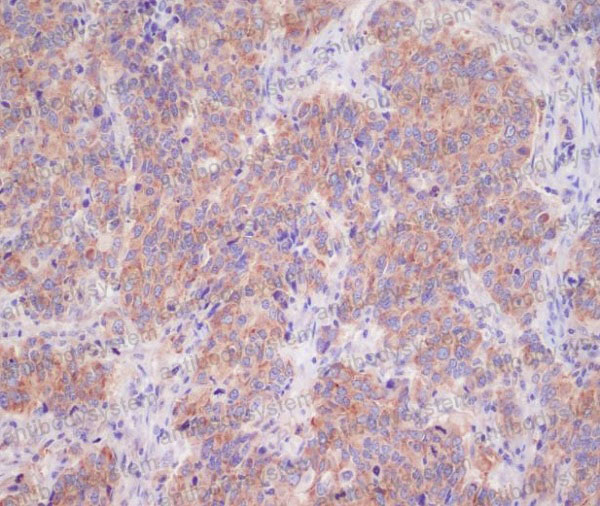 Anti-YWHAB Antibody (R1U33)
