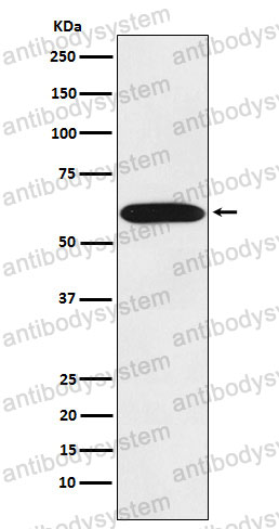 Anti-STIP1 Antibody (R1U38)