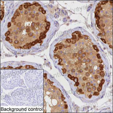 Anti-STIP1 Antibody (R3J28)