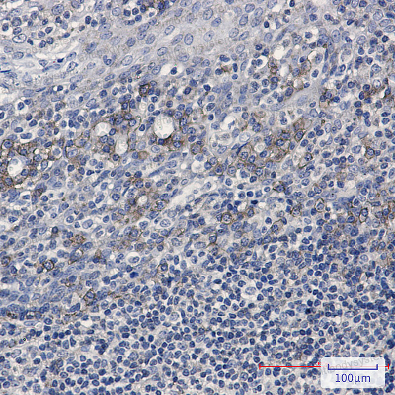 Anti-CD32b/FCGR2B Antibody (R1U40)