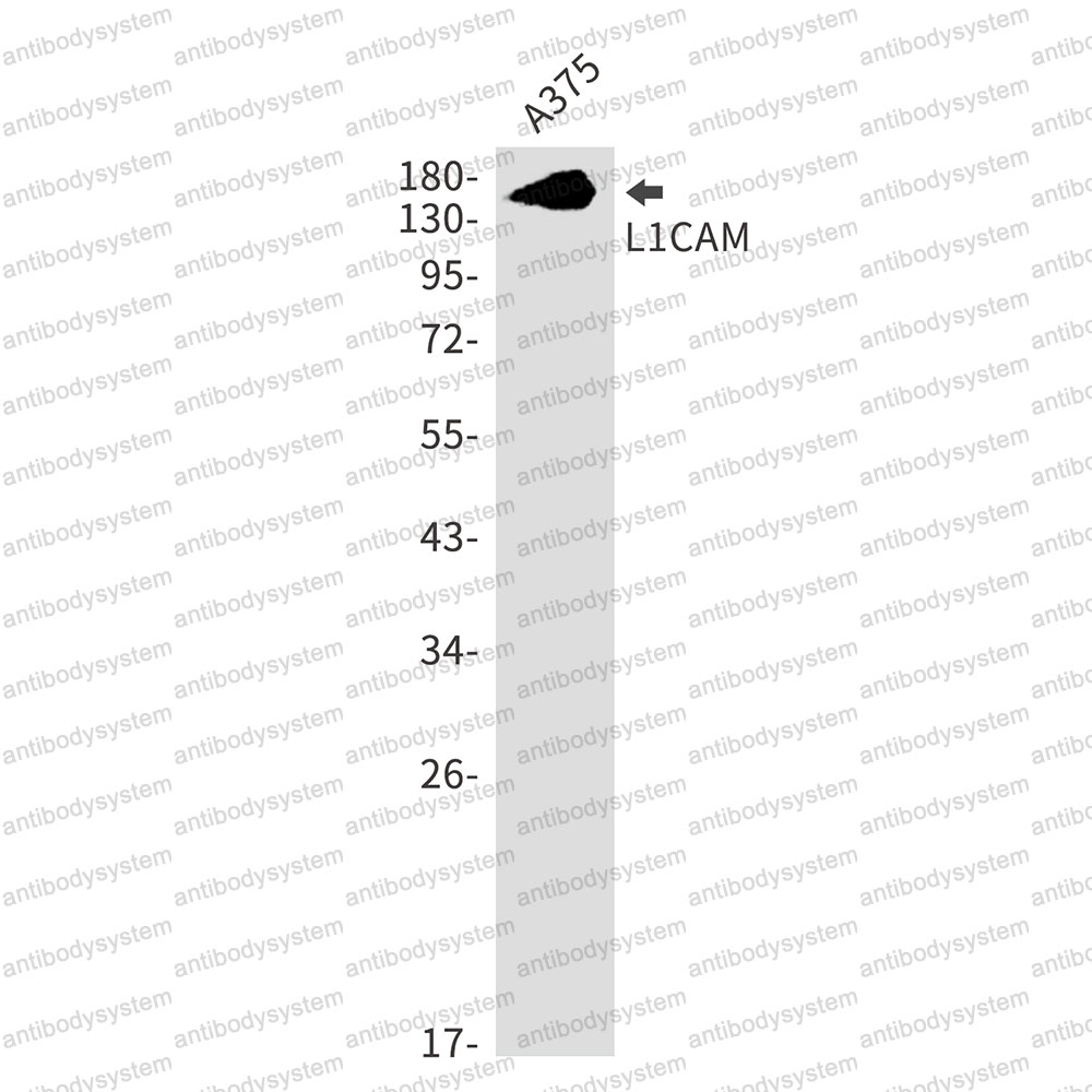 Anti-CD171/L1CAM Antibody (R1U41)