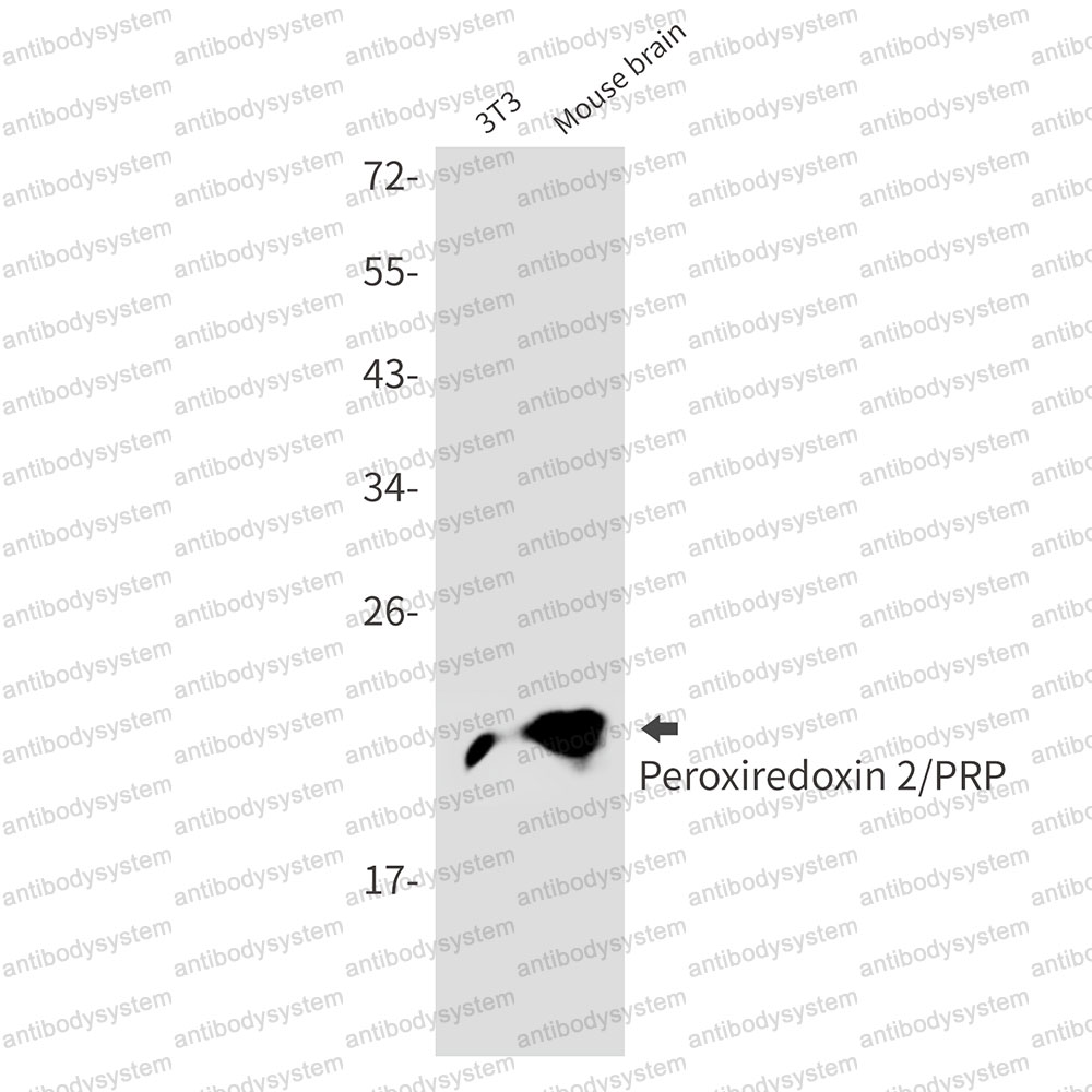 Anti-PRDX2 Antibody (R1U44)