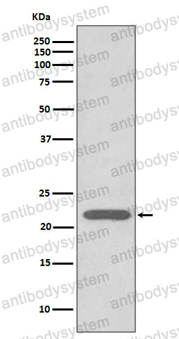 Anti-PRDX2 Antibody (R1U42)