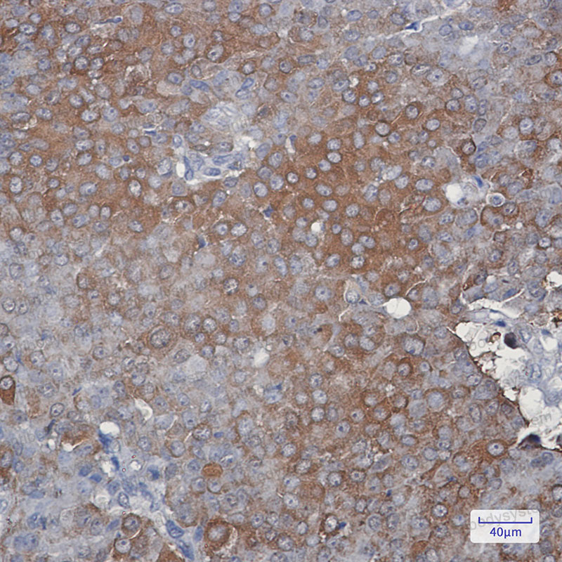 Anti-PRDX2 Antibody (R1U43)