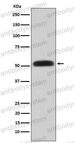 Anti-GK Antibody (R1U45)