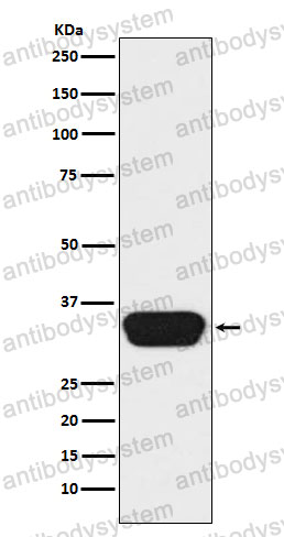 Anti-OTX1 Antibody (R1U46)