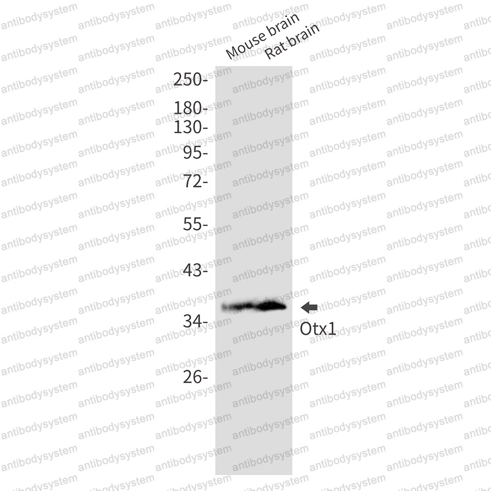 Anti-OTX1 Antibody (R1U47)
