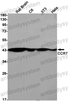 Anti-CD197/CCR7 Antibody (R1U49)