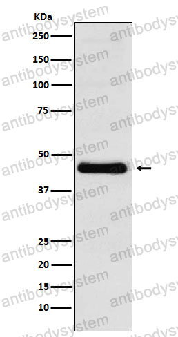 Anti-CD185/CXCR5 Antibody (R1U50)