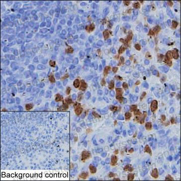 Anti-CDA Antibody (R3J38)