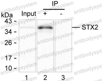 Anti-STX2 Antibody (R3J41)