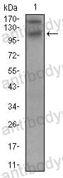 Anti-DSG3 Antibody (R3J43)