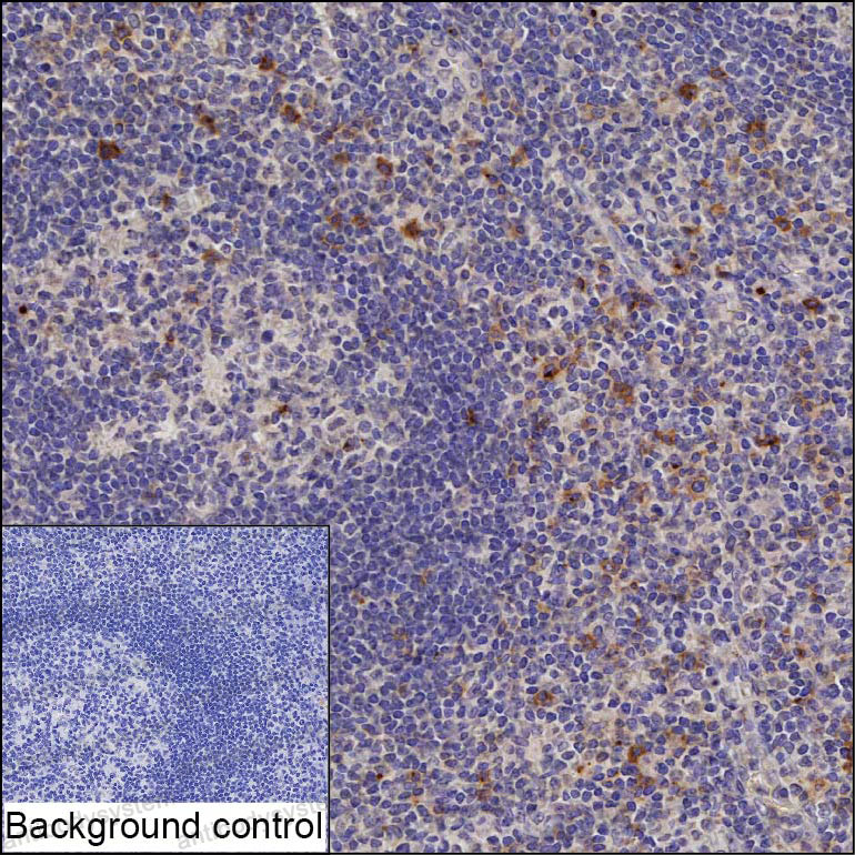 Anti-CD70 Antibody (R3J48)