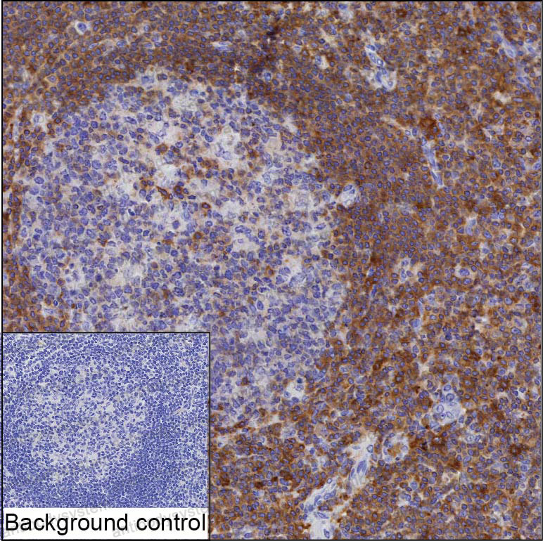 Anti-LSP1 Antibody (R3J50)