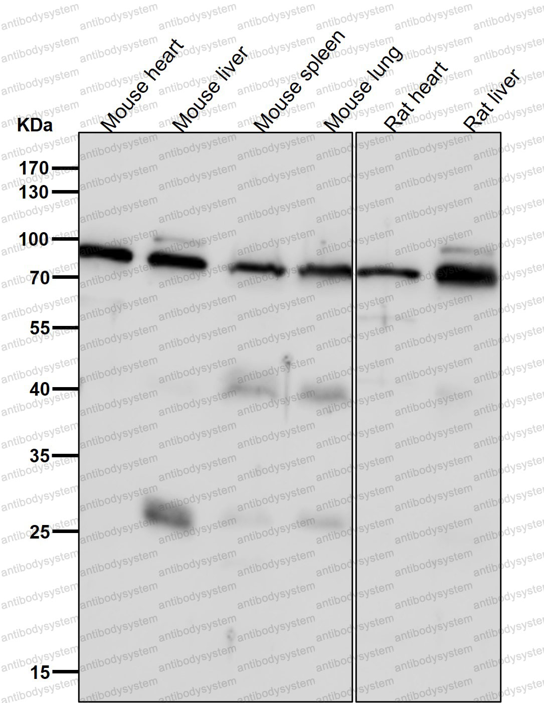 Anti-ABCD1/ALD Antibody (R1B54)