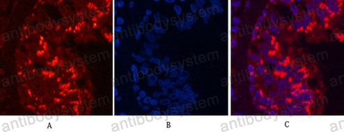 Anti-CD68 Antibody (R3J56)