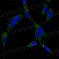 Anti-HSPA4/HSP70 Antibody (R3J59)