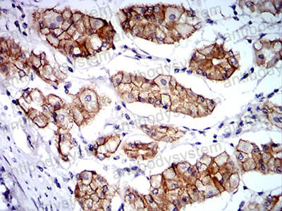 Anti-CTNNA1 Antibody (R3J64)