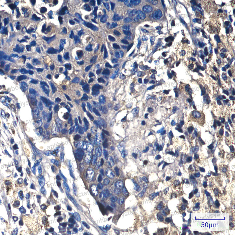 Anti-CTNNB1 Antibody (R3J69)