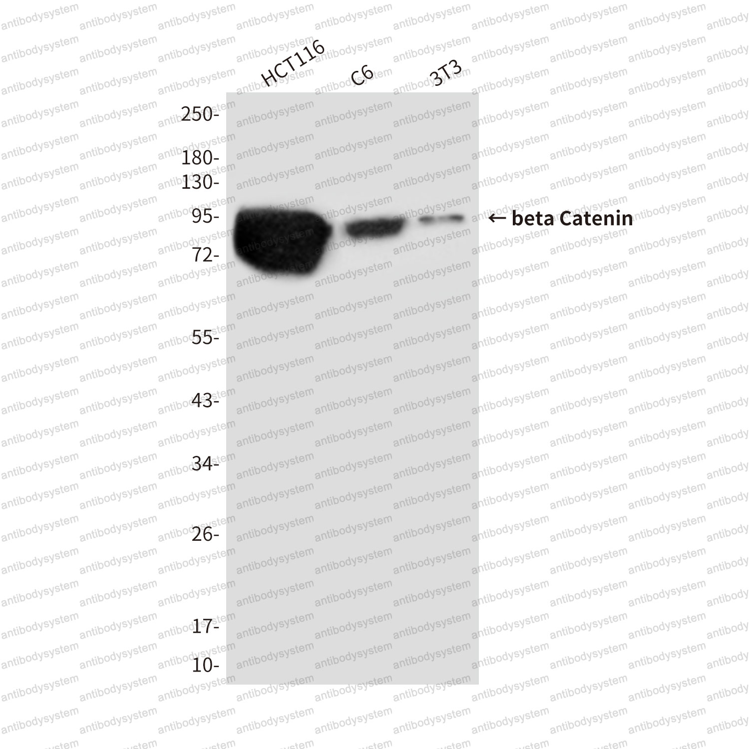Anti-CTNNB1 Antibody (R3J70)