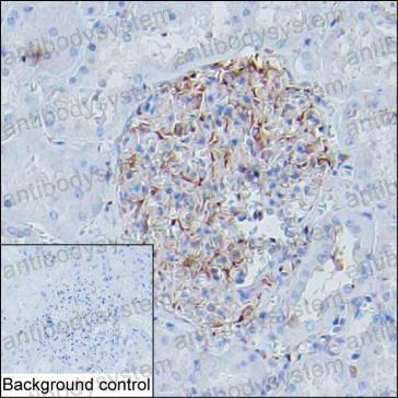 Anti-MYH9 Antibody (R3J79)