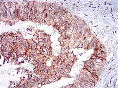 Anti-TIE1 Antibody (R3J81)