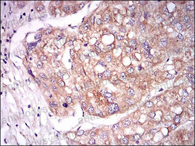 Anti-TIE1 Antibody (R3J80)