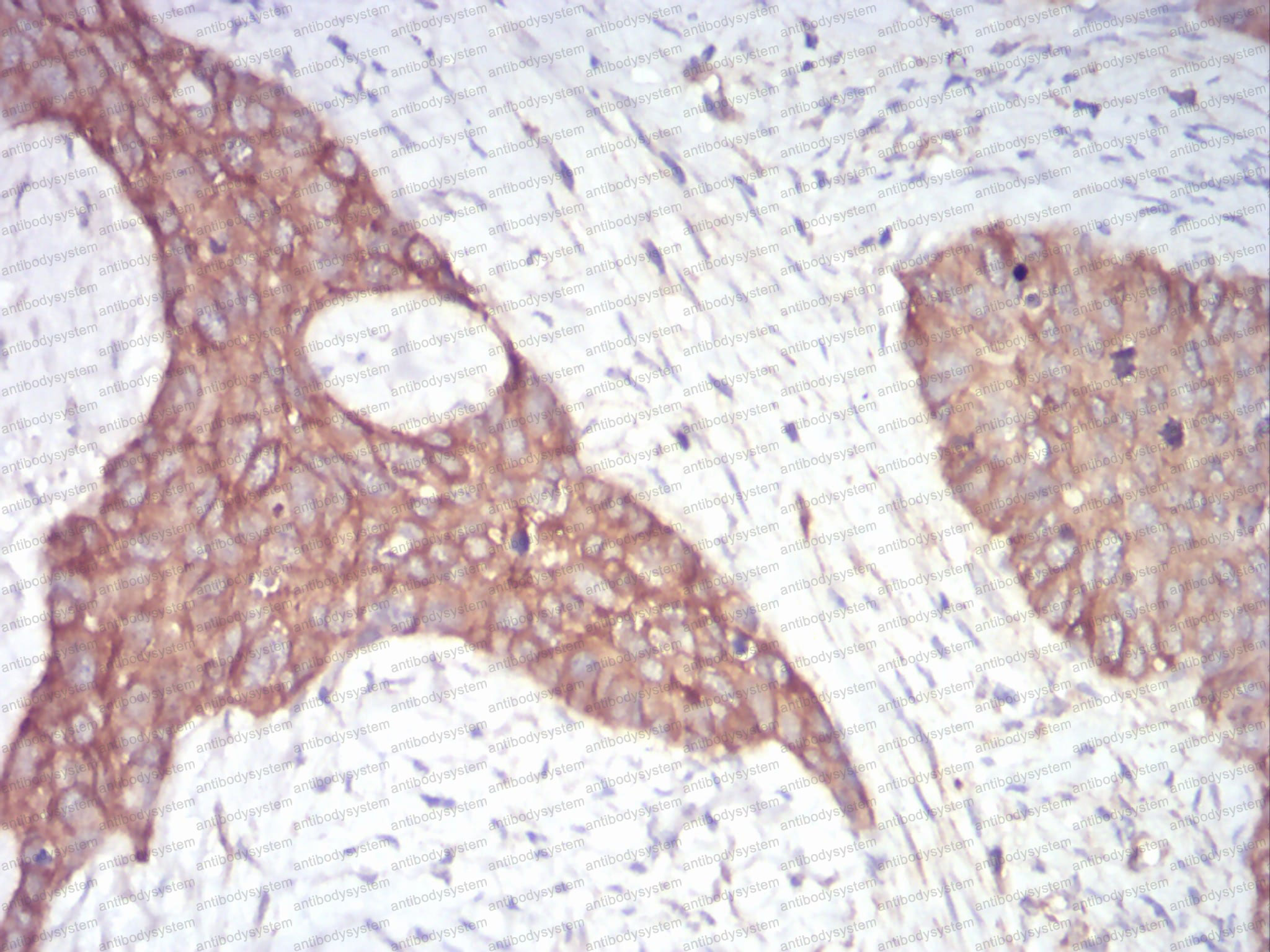 Anti-ADD1 Antibody (R3J83)