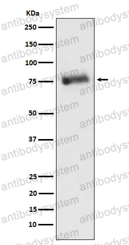 Anti-GRK3 Antibody (R1V20)
