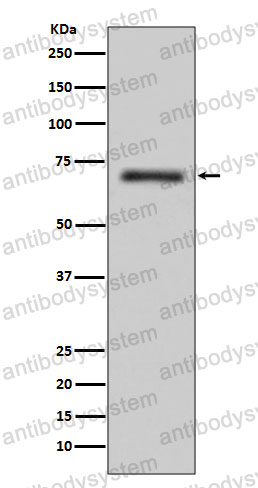 Anti-FUS/TLS Antibody (R1V21)
